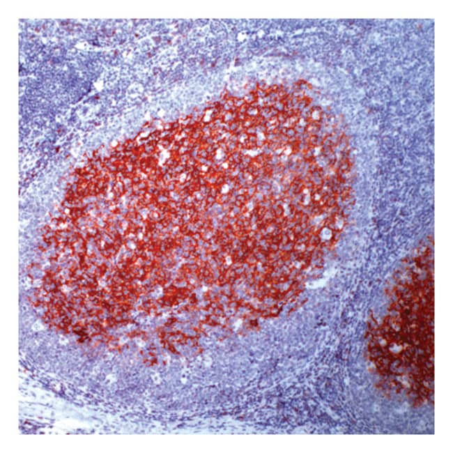 7 ML CD23 (SP23) RABBIT MAB READY-TO-USE