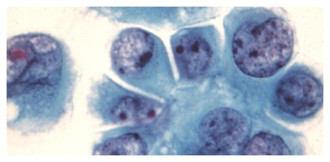 5 LT SHANDON CYTOLOGY STAIN EA-65 CE-IVD