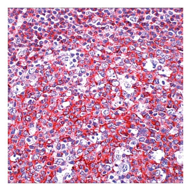 CD45 / T200 / LCA 1mL