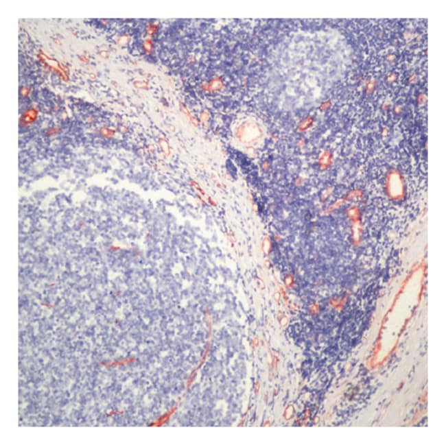 Factor VIII Rel Ant mAb