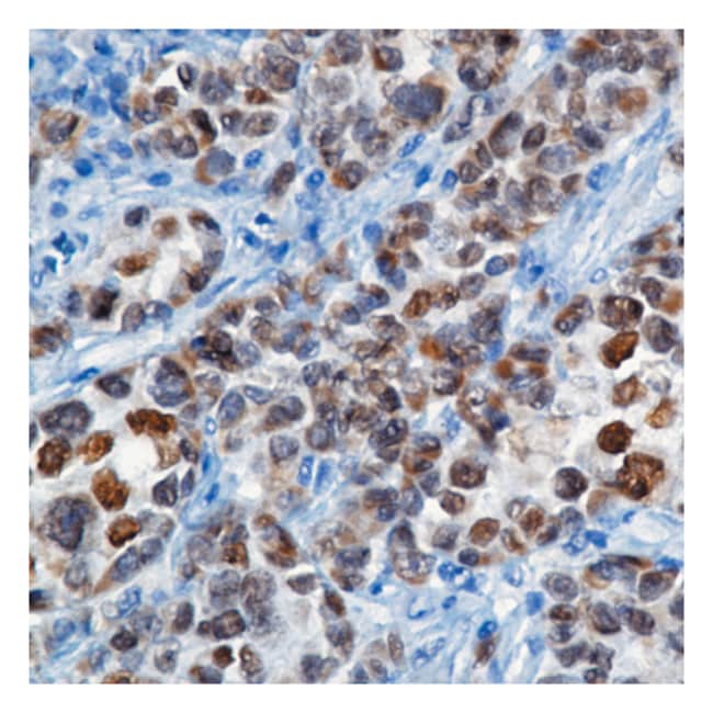 Microphthalmia (Trans Fac) mAb