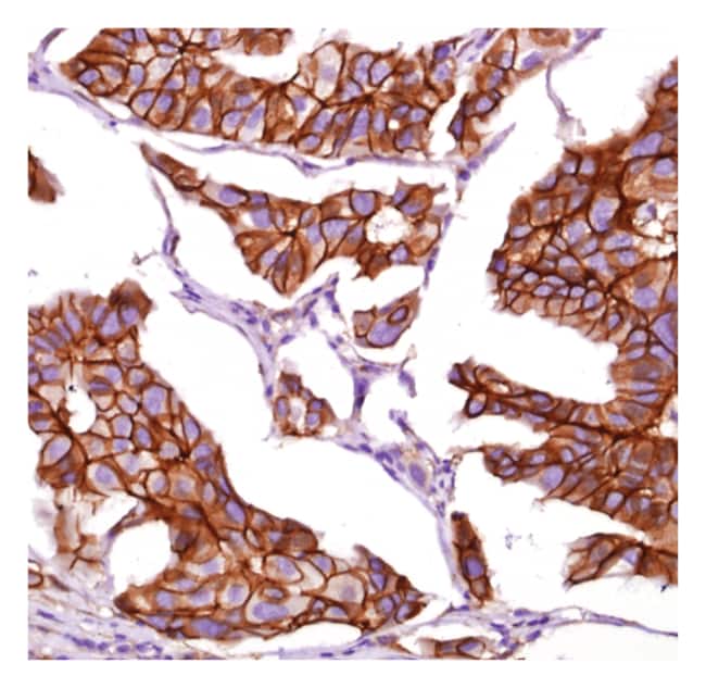 Beta-catenin 1mL