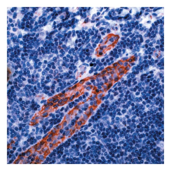 1 ML CD31 RABBIT PAB (PURIFIED AB WITH B
