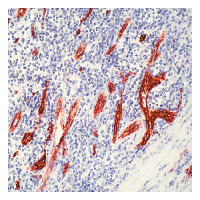 Factor VIII Rel Ant Rb pAb