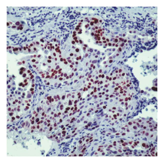 Thyroid Transcription Factor-1(TTF-1) 1m