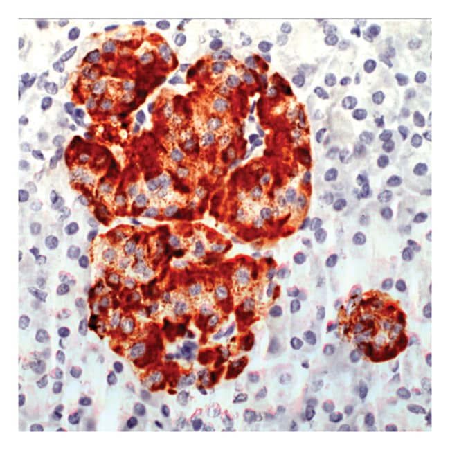 1 ML CHROMOGRANIN A ( SP12) RABBIT MAB (