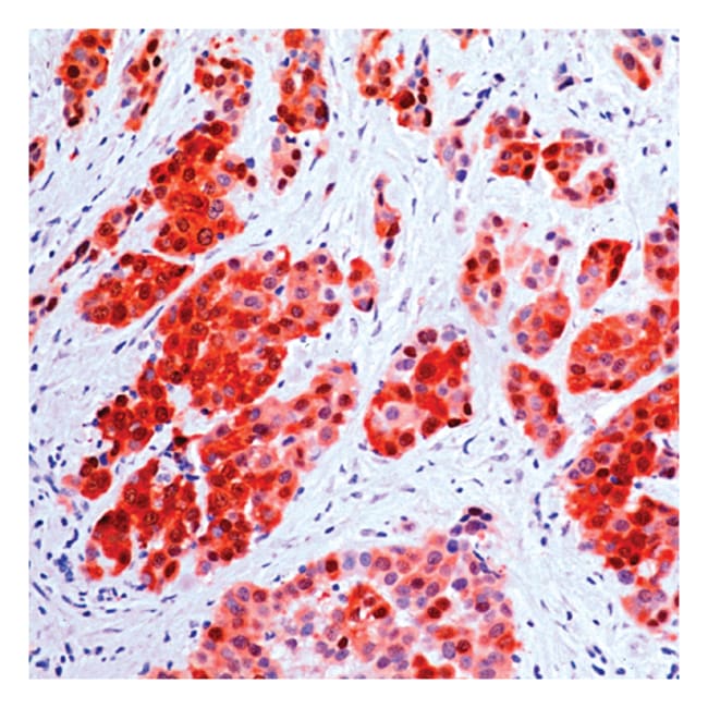 1 ML CALRETININ (SP13) RABBIT MAB (SUPER