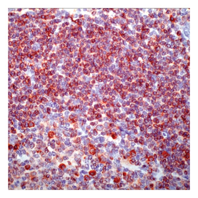 7 ML CD79A / MB-1 (B-CELL MARKER) (SP18)