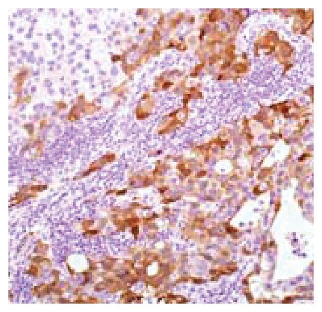 NY-BR-1 1mL
