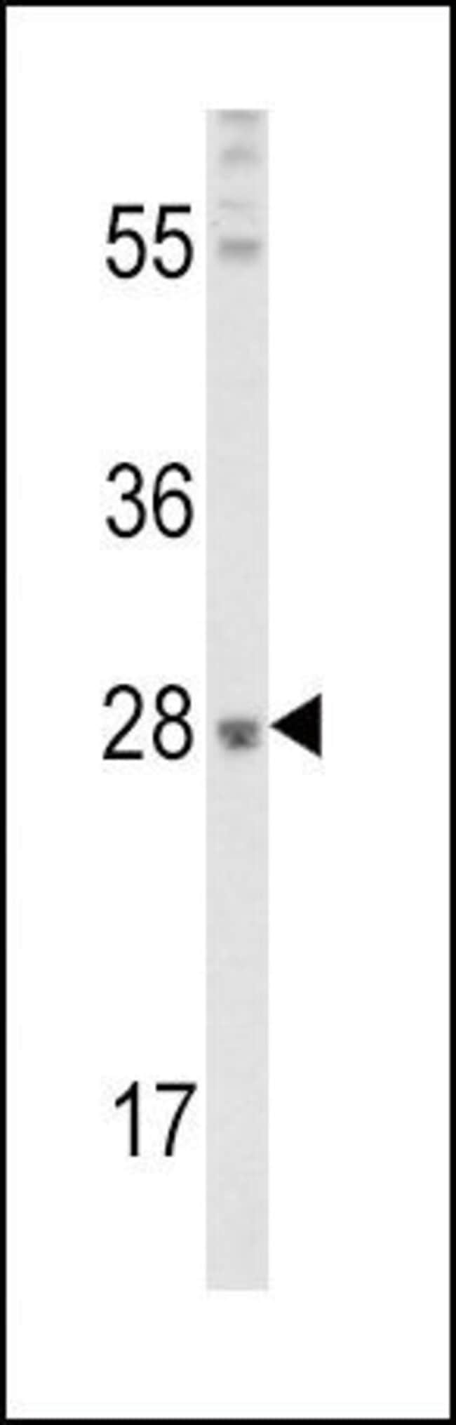 ANTI-FGF10, 0,1 MG