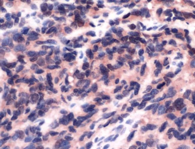 500uL Polyclonal antibody, FLI-1, host r