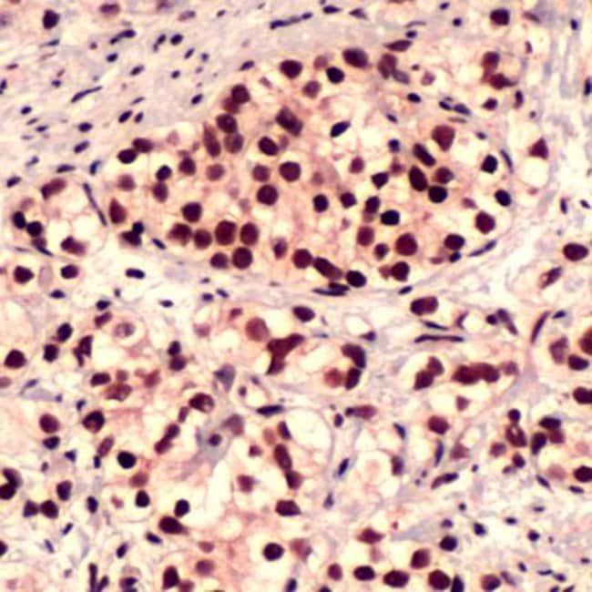 500uL Polyclonal antibody, FOXO1A, host
