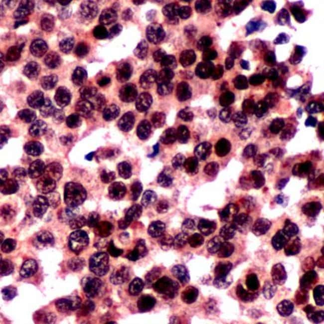 500uL Polyclonal antibody, FOXO3A, host