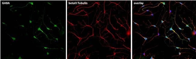 100uL Polyclonal antibody, GABA, host ra