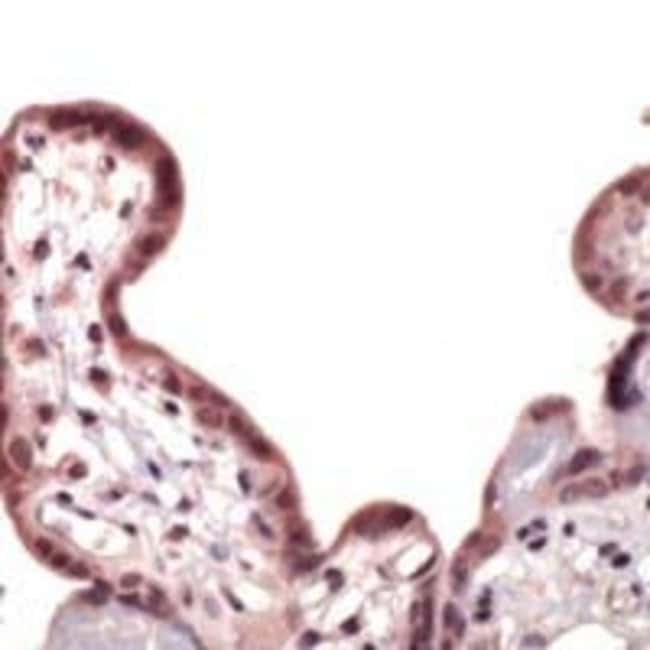 1 ML Nrf2 Rabbit polyclonal antibody IgG