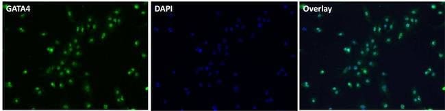 100UG Polyclonal antibody, anti-GATA4, h