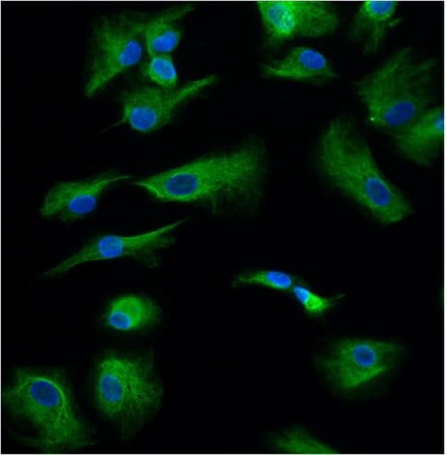 1 ML GFAP Mouse monoclonal antibody IgG1