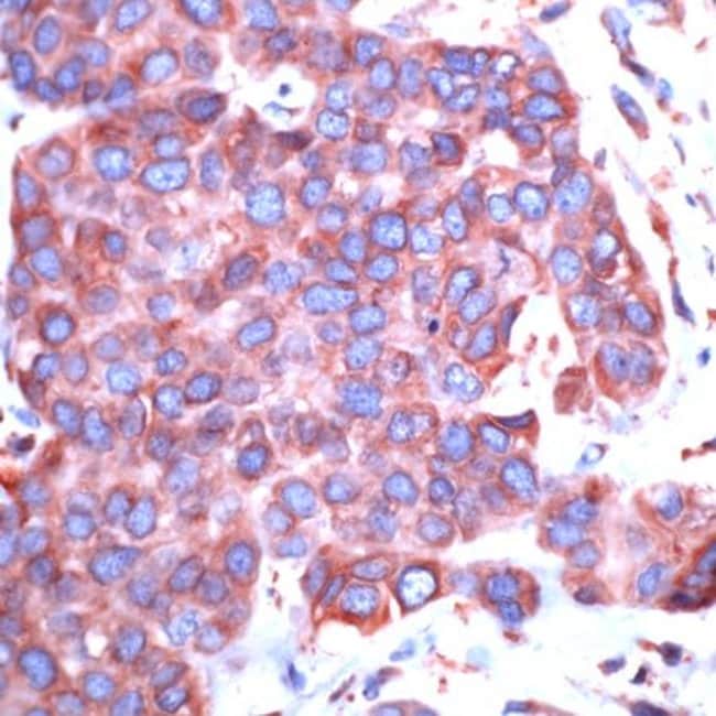 500uL Polyclonal antibody, GRP78, host r