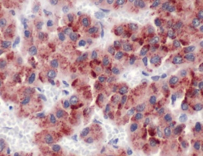 500uL Polyclonal antibody, glypican-3, h