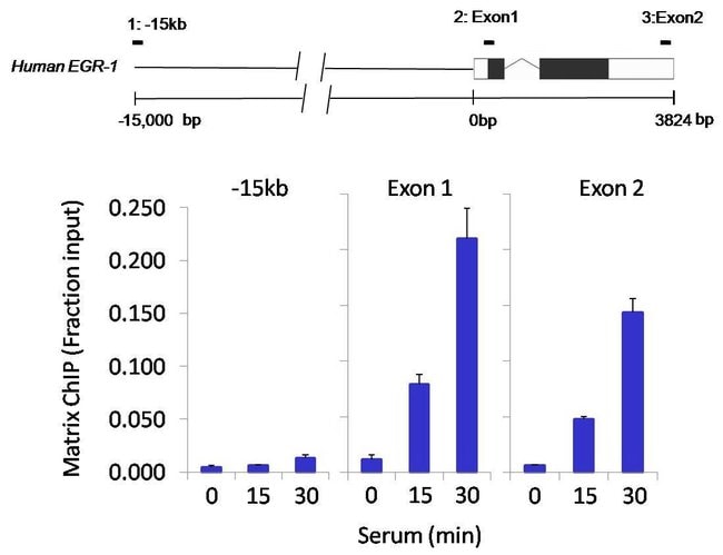 Antibody Phospho-HDAC4 (Ser246)/ HDAC5 (