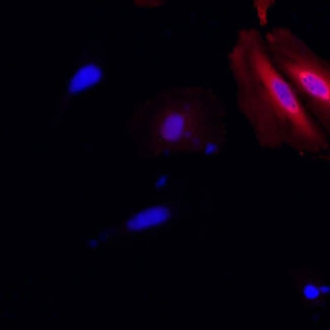 100UG 6X-HIS  Epitope Tag AB Alexa Fluor