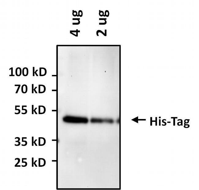 100UG 6X-HIS Epitope Tag AB (HIS.H8) HRP