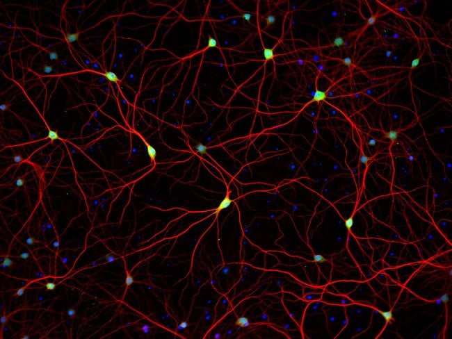 ANTI-HUC/HUD NEURONAL PRO anti-HuC/HuD n