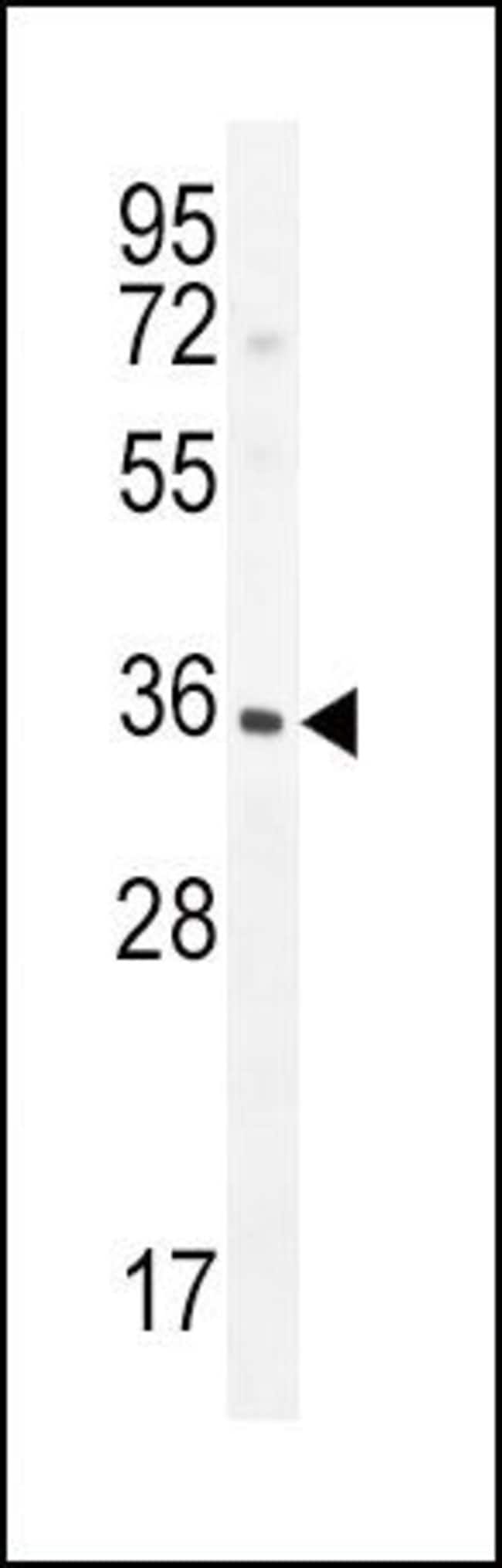 ANTI-IGFBP3, 0,1mg .