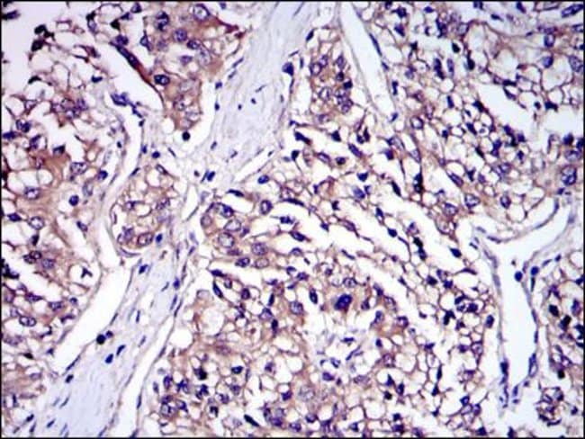 Anti-IRAK4 Monoclonal Antibody 100µl
