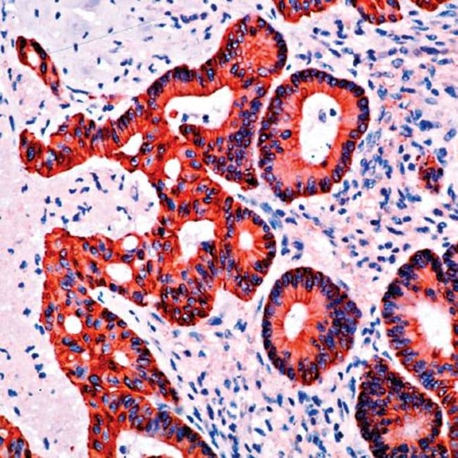 500uL Polyclonal antibody, keratin 19, h