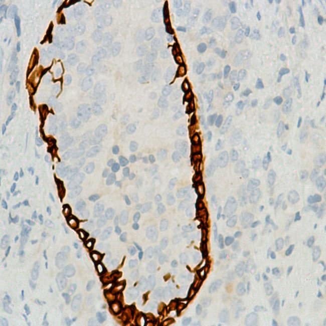 Anti-Keratin 6