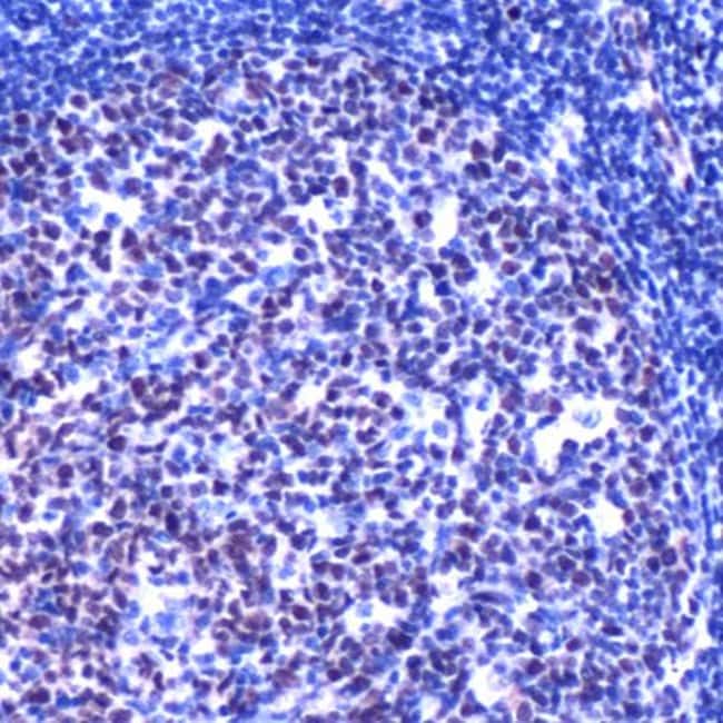 500uL Polyclonal antibody, LMO2, host ra
