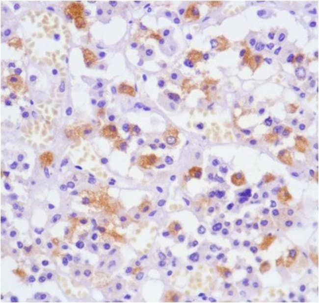 Anti-Luteinizing Hormone