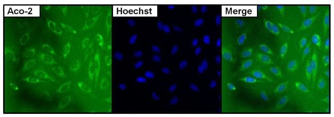 ACO2 Monoclonal Antibody (7G4) Sample Si