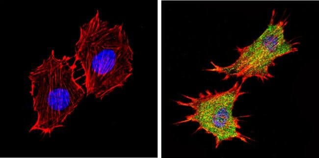 AKT2 Monoclonal Antibody (4H7) Sample Si