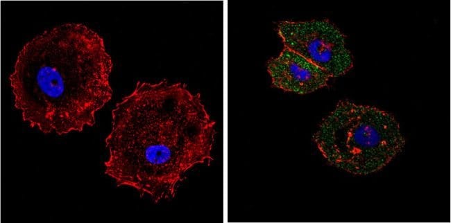 EIF4E MONOCLONAL ANTIBODY (5D11)