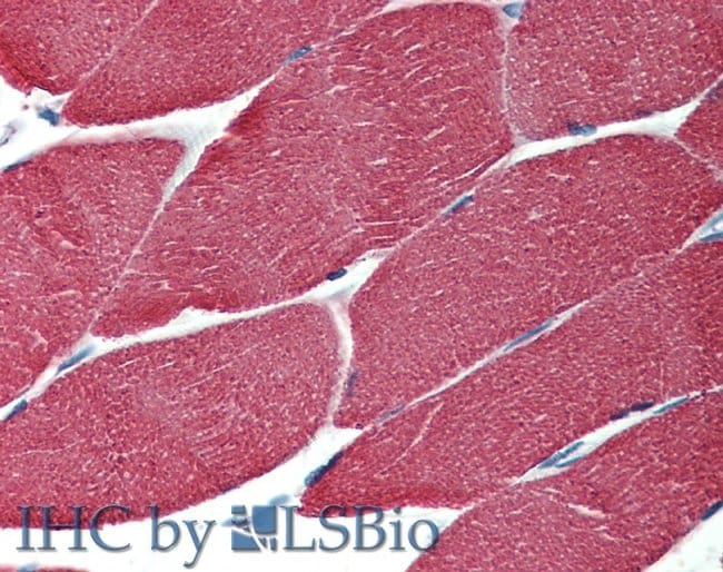 Anti-Actin Monoclonal Antibody (HHF35),