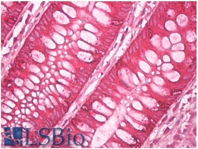 Anti-AGR2+AGR3 Monoclonal Antibody
