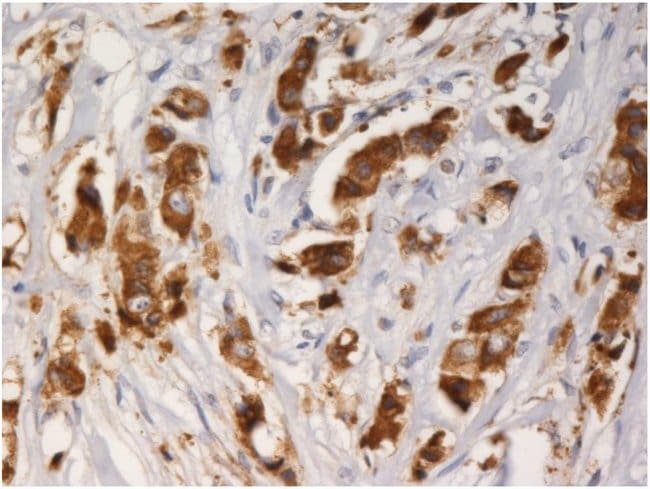 Anti-AGR3 Monoclonal Antibody (AGR3.1),