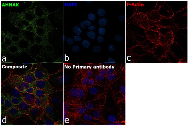 Anti-AHNAK1 Monoclonal Antibody (EM-09),