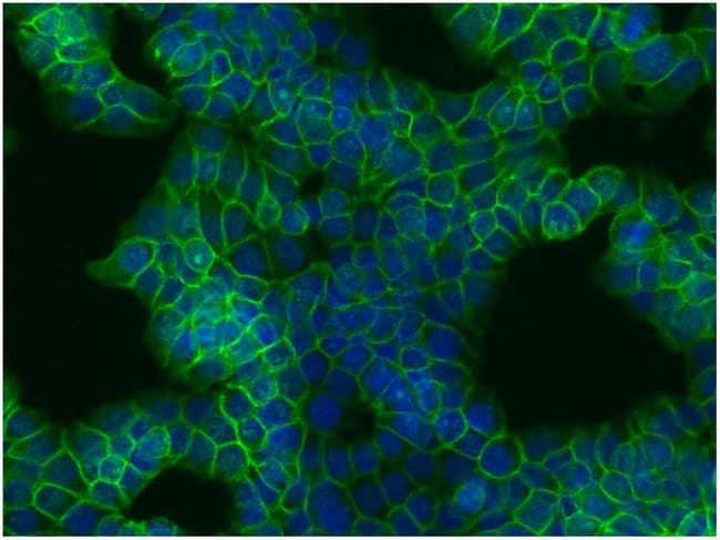 Anti-beta-Catenin Monoclonal Antibody
