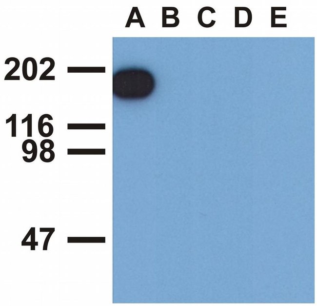 Anti-EGFR (Phospho-Tyr1173) Monoclonal