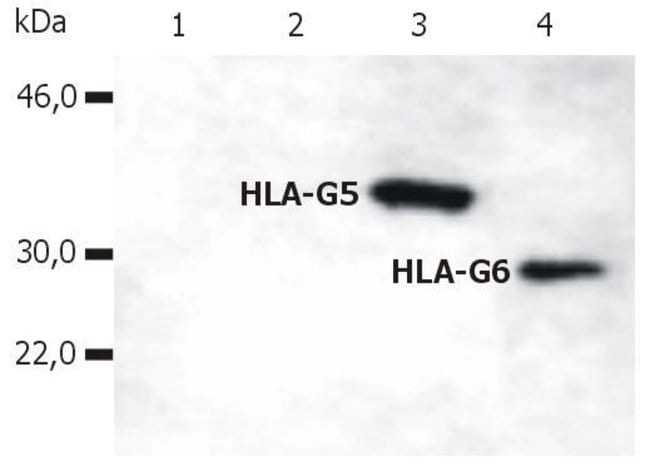 Anti-HLA-G Monoclonal Antibody