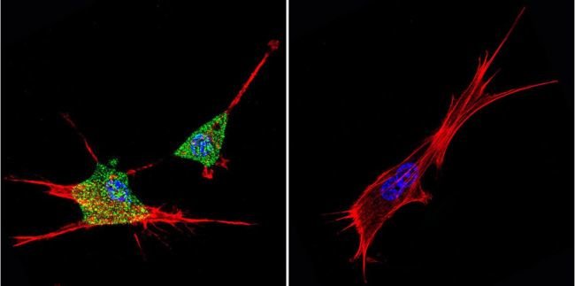 Anti-ZPR1 Monoclonal Antibody 1 EA = 100