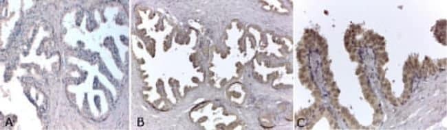 ANDROGEN RECEPTOR