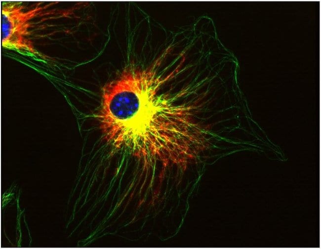 ALPHA TUBULIN
