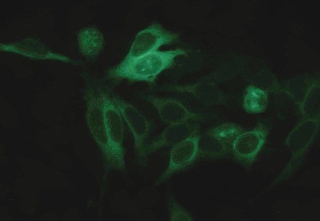 ALPHA TUBULIN