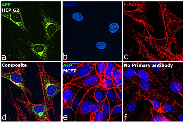 ALPHA FETOPROTEIN