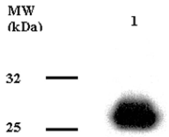 ADIPONECTIN
