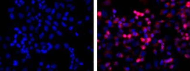 6X-HIS EPITOPE TAG